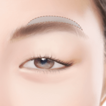 https://beauty.findclinic.kr/wp-content/uploads/sites/14/2020/05/above-eyebrow03.png