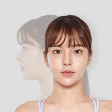 https://beauty.findclinic.kr/wp-content/uploads/sites/14/2020/05/barbie-process03.png
