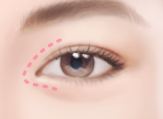 https://beauty.findclinic.kr/wp-content/uploads/sites/14/2020/05/circle-3-Procedures1.png