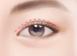 https://beauty.findclinic.kr/wp-content/uploads/sites/14/2020/05/circle-3-Procedures2.png