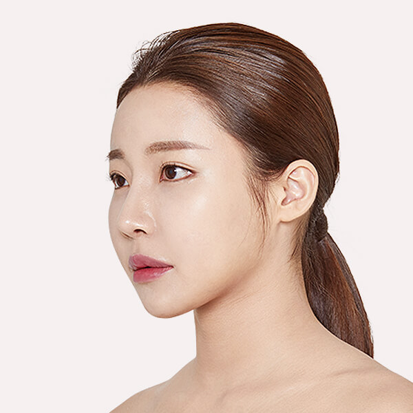 https://beauty.findclinic.kr/wp-content/uploads/sites/14/2020/05/circle-after02.jpg