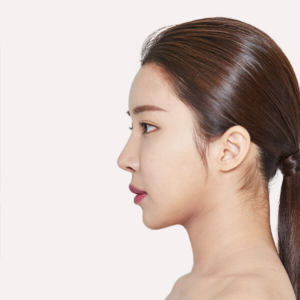 https://beauty.findclinic.kr/wp-content/uploads/sites/14/2020/05/circle-after03.jpg