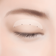 https://beauty.findclinic.kr/wp-content/uploads/sites/14/2020/05/circle-eyes-process02.png