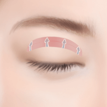 https://beauty.findclinic.kr/wp-content/uploads/sites/14/2020/05/circle-eyes-process03.png