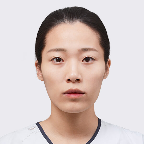 https://beauty.findclinic.kr/wp-content/uploads/sites/14/2020/05/double-before01.jpg