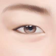 https://beauty.findclinic.kr/wp-content/uploads/sites/14/2020/05/double-lock-process01.png