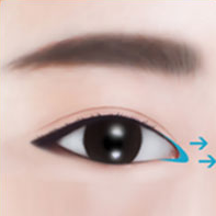 https://beauty.findclinic.kr/wp-content/uploads/sites/14/2020/05/epi-process03-1.png