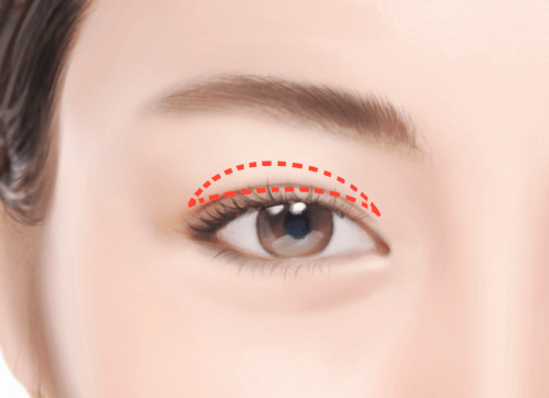 https://beauty.findclinic.kr/wp-content/uploads/sites/14/2020/05/eyebrow-Chara02.png