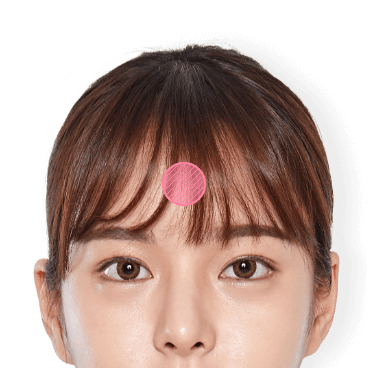 https://beauty.findclinic.kr/wp-content/uploads/sites/14/2020/05/fat-grafting-applied01.png