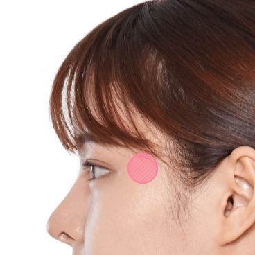 https://beauty.findclinic.kr/wp-content/uploads/sites/14/2020/05/fat-grafting-applied02.png