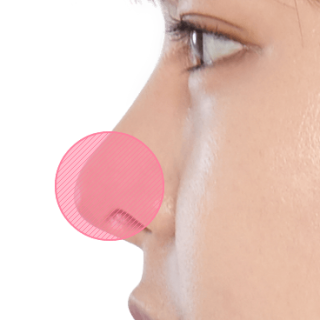 https://beauty.findclinic.kr/wp-content/uploads/sites/14/2020/05/fat-grafting-applied05-320x320.png