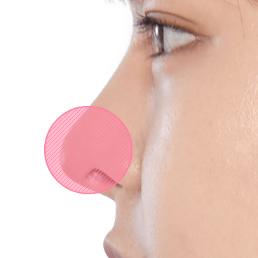 https://beauty.findclinic.kr/wp-content/uploads/sites/14/2020/05/fat-grafting-applied05.png