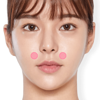 https://beauty.findclinic.kr/wp-content/uploads/sites/14/2020/05/fat-grafting-applied06-320x320.png