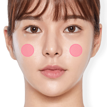https://beauty.findclinic.kr/wp-content/uploads/sites/14/2020/05/fat-grafting-applied07.png