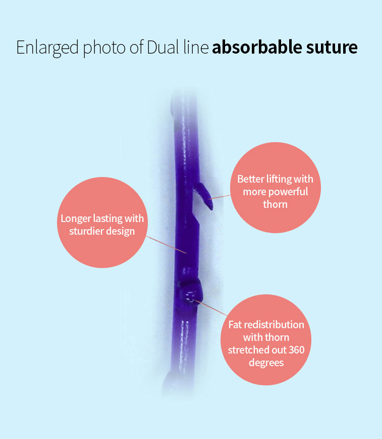 https://beauty.findclinic.kr/wp-content/uploads/sites/14/2020/05/fat-x-lifting-left.png