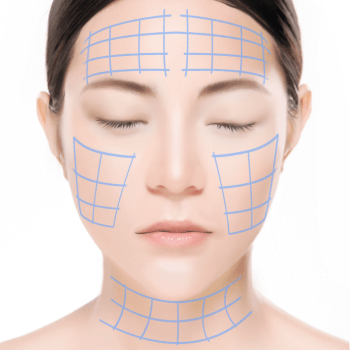 https://beauty.findclinic.kr/wp-content/uploads/sites/14/2020/05/fatty-surgery-Process03.png