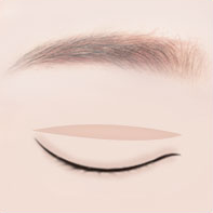 https://beauty.findclinic.kr/wp-content/uploads/sites/14/2020/05/incision-double-process02.png