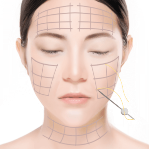 https://beauty.findclinic.kr/wp-content/uploads/sites/14/2020/05/intense-process02.png