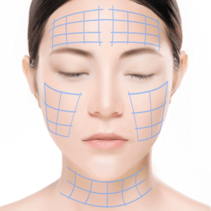 https://beauty.findclinic.kr/wp-content/uploads/sites/14/2020/05/intense-process03.png