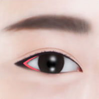 https://beauty.findclinic.kr/wp-content/uploads/sites/14/2020/05/lateral-process02.png