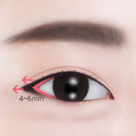 https://beauty.findclinic.kr/wp-content/uploads/sites/14/2020/05/lateral-process03.png