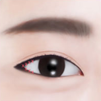 https://beauty.findclinic.kr/wp-content/uploads/sites/14/2020/05/lateral-process04.png