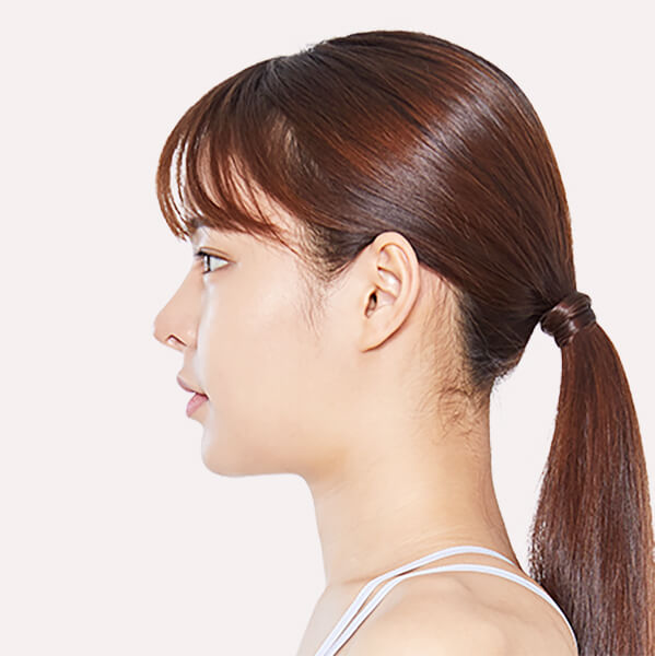 https://beauty.findclinic.kr/wp-content/uploads/sites/14/2020/05/lifting-after03.jpg