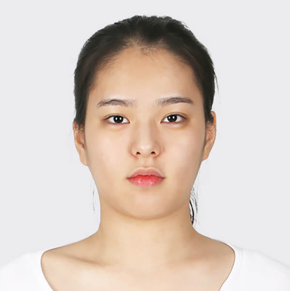 https://beauty.findclinic.kr/wp-content/uploads/sites/14/2020/05/lifting-before01.jpg