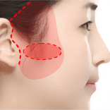 https://beauty.findclinic.kr/wp-content/uploads/sites/14/2020/05/smas-lifting-process02.png