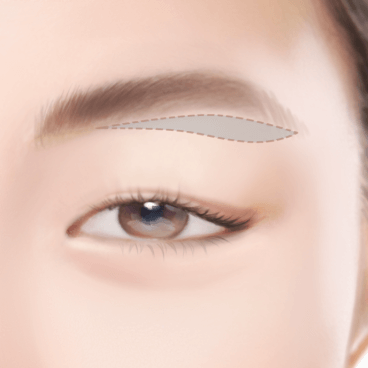 https://beauty.findclinic.kr/wp-content/uploads/sites/14/2020/05/under-eyebrow02.png