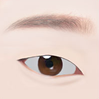 https://beauty.findclinic.kr/wp-content/uploads/sites/14/2020/05/upper-eye-process01.png