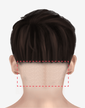 https://beauty.findclinic.kr/wp-content/uploads/sites/14/2020/06/back-of-scalp01.png