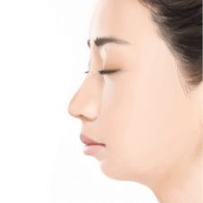 https://beauty.findclinic.kr/wp-content/uploads/sites/14/2020/06/chin-process-07.png