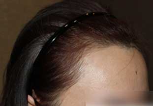 https://beauty.findclinic.kr/wp-content/uploads/sites/14/2020/06/core-balance-line01.jpg