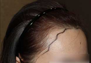 https://beauty.findclinic.kr/wp-content/uploads/sites/14/2020/06/core-balance-line02.jpg