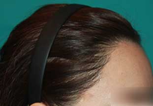 https://beauty.findclinic.kr/wp-content/uploads/sites/14/2020/06/core-balance-line03.jpg