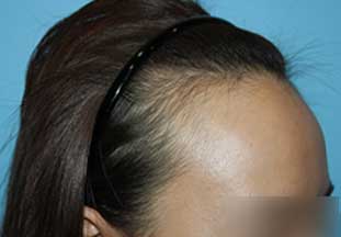 https://beauty.findclinic.kr/wp-content/uploads/sites/14/2020/06/core-balance-line04.jpg