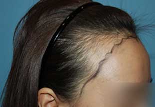 https://beauty.findclinic.kr/wp-content/uploads/sites/14/2020/06/core-balance-line05.jpg