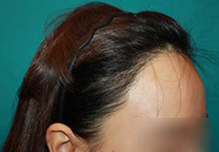 https://beauty.findclinic.kr/wp-content/uploads/sites/14/2020/06/core-balance-line06.jpg