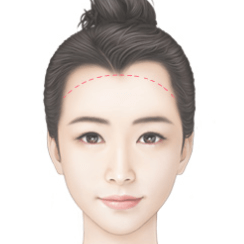https://beauty.findclinic.kr/wp-content/uploads/sites/14/2020/06/general-hairline02.png