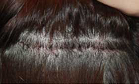 https://beauty.findclinic.kr/wp-content/uploads/sites/14/2020/06/hair-without-trace01.jpg