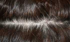 https://beauty.findclinic.kr/wp-content/uploads/sites/14/2020/06/hair-without-trace02.jpg
