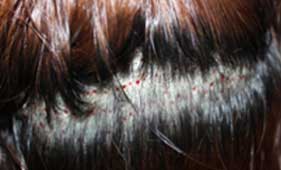 https://beauty.findclinic.kr/wp-content/uploads/sites/14/2020/06/hair-without-trace03.jpg