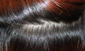 https://beauty.findclinic.kr/wp-content/uploads/sites/14/2020/06/hair-without-trace04.jpg