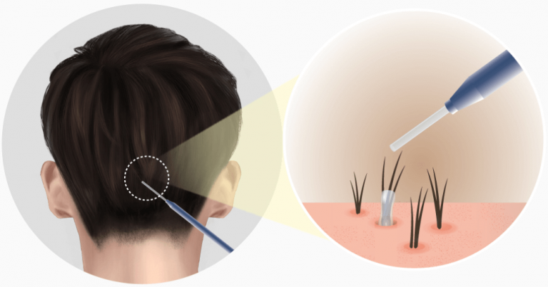 https://beauty.findclinic.kr/wp-content/uploads/sites/14/2020/06/harvest-healthy-hair01-768x403.png