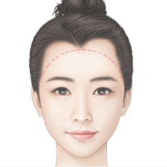 https://beauty.findclinic.kr/wp-content/uploads/sites/14/2020/06/mojelim-side02.png