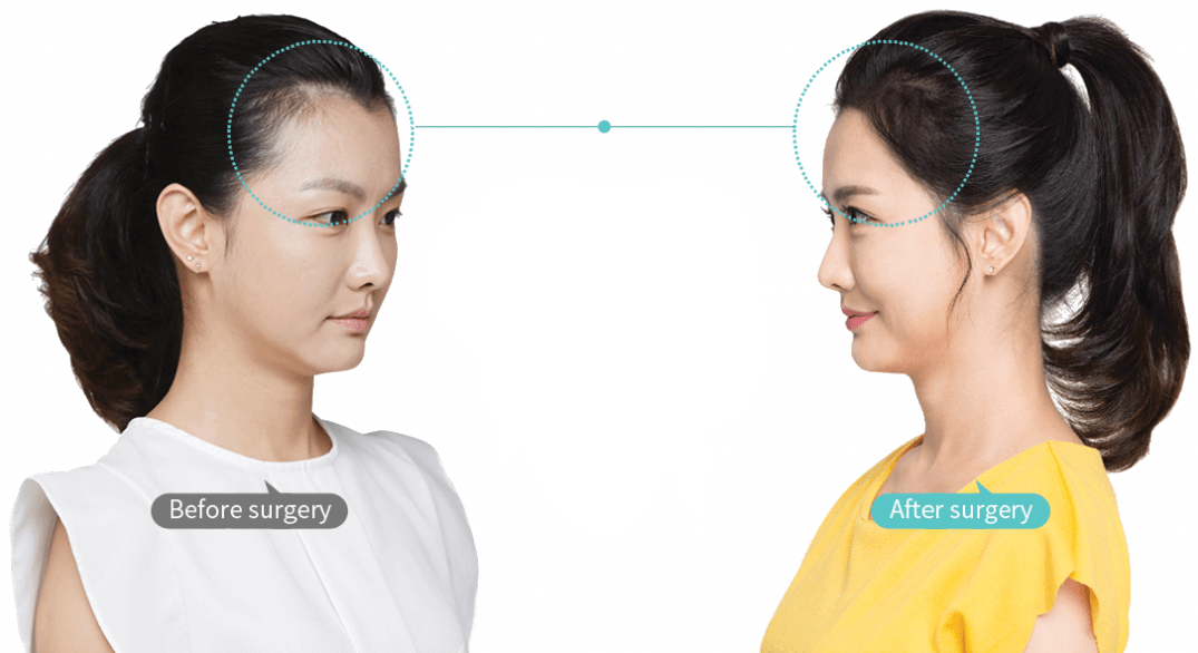 https://beauty.findclinic.kr/wp-content/uploads/sites/14/2020/06/only-feminine-img.png