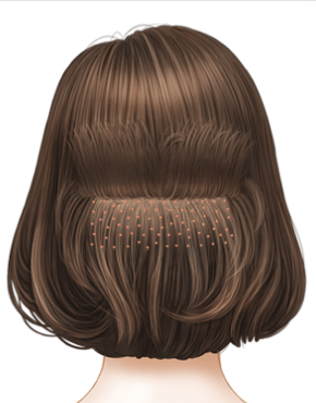 https://beauty.findclinic.kr/wp-content/uploads/sites/14/2020/06/shair-cut-method04.png
