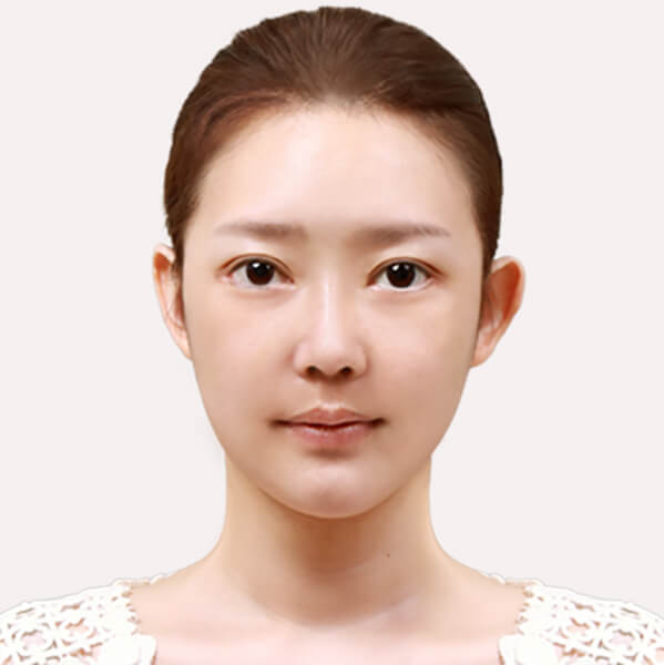 https://beauty.findclinic.kr/wp-content/uploads/sites/14/2020/06/skin-after01.jpg