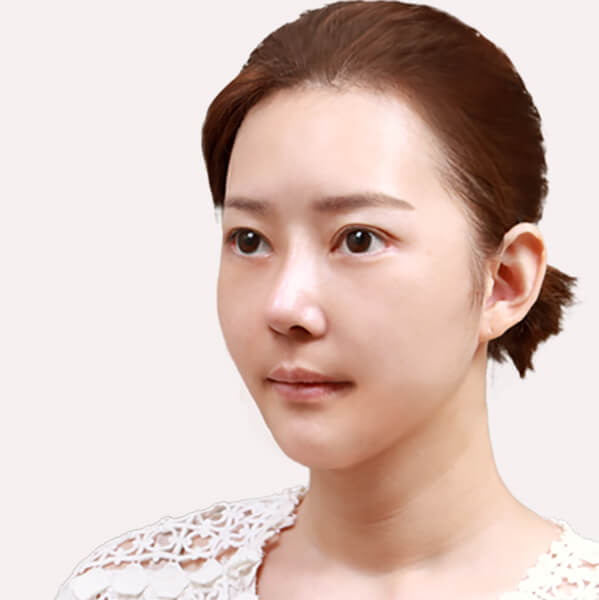https://beauty.findclinic.kr/wp-content/uploads/sites/14/2020/06/skin-after02.jpg